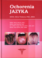 Ochorenia jazyka