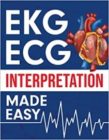 EKG ECG interpretation made easy: an illustrated study guide for students to easily learn how to read & interpret ECG strips