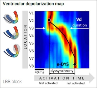 Fig. 2: Example of depolarization map